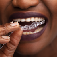 Invisalign First for Children  Dr. Aly Kanani, Vancouver Orthodontist