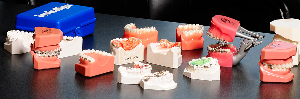 Invisalign First for Children  Dr. Aly Kanani, Vancouver Orthodontist
